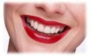 The basics of tooth whitening