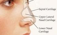 Considering a nose job? Get the facts first