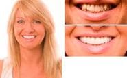 Improving your teeth and your smile