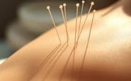 What Acupuncture Actually Feels Like: A First-Timer's Guide