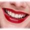 The basics of tooth whitening