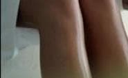 Laser hair removal FAQ