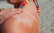 Protect your skin against melanoma